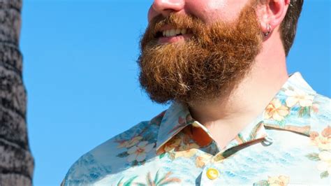 why is my beard white.